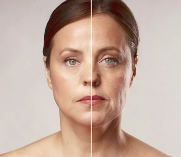 Vorher und nachher Portraet einer reifen Frau mit und ohne Botox Behandlung